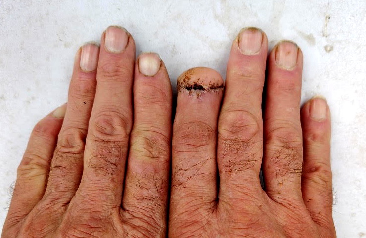 finger 10 19 26.jpg