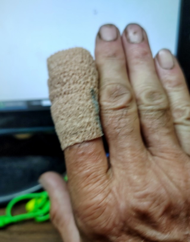 finger today.jpg